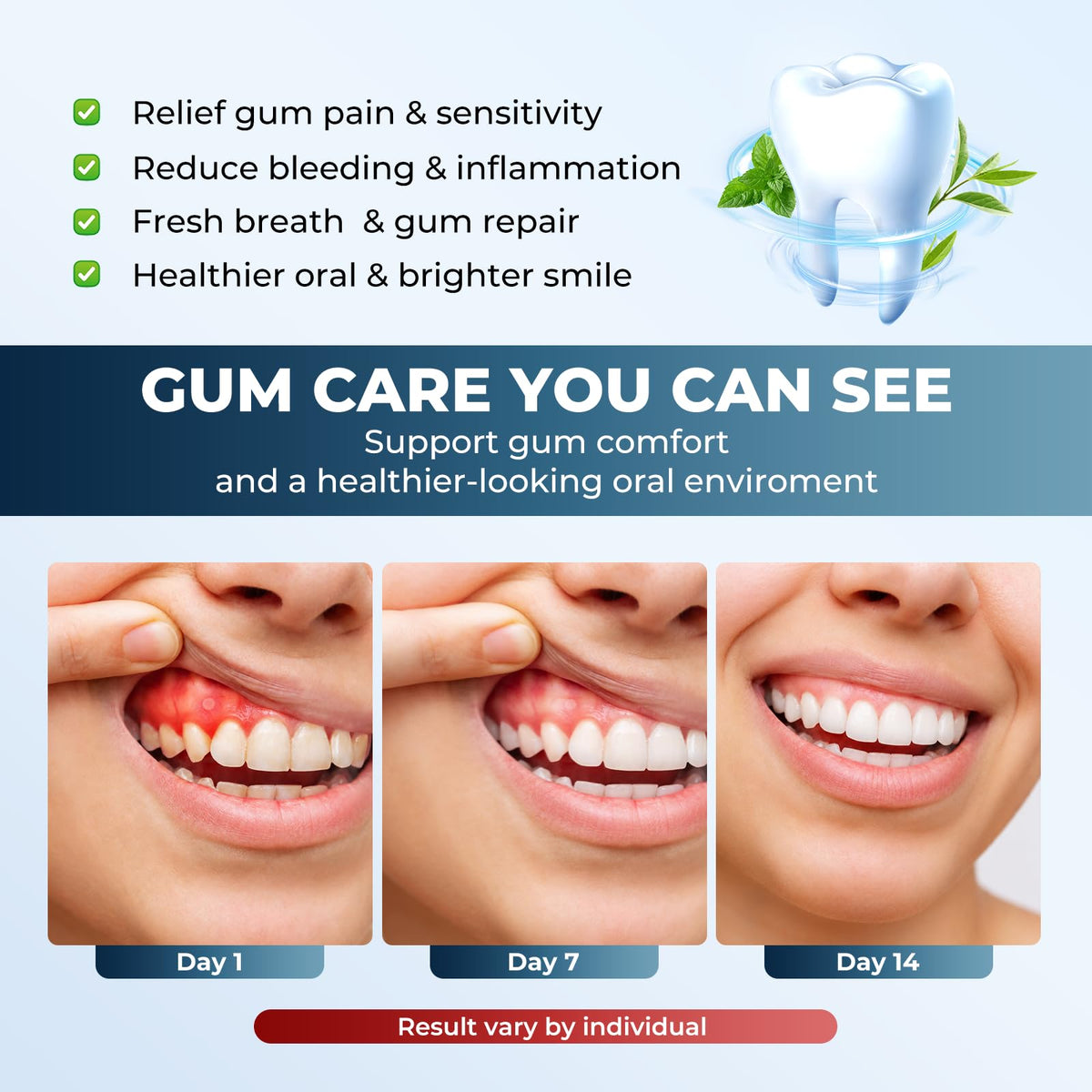 Red Light Therapy Mouthpiece LED Gum Care for Oral Health