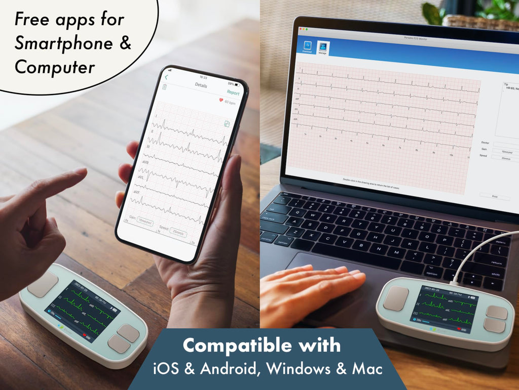 Portable 6 Channel ECG Monitor with Heart Rate Tracking for Home Use