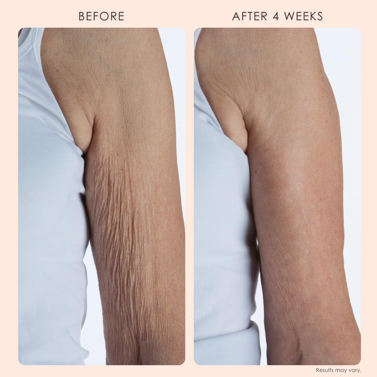 Body Repair Treatment Anti Aging Wrinkle Cream Skin Firming Care
