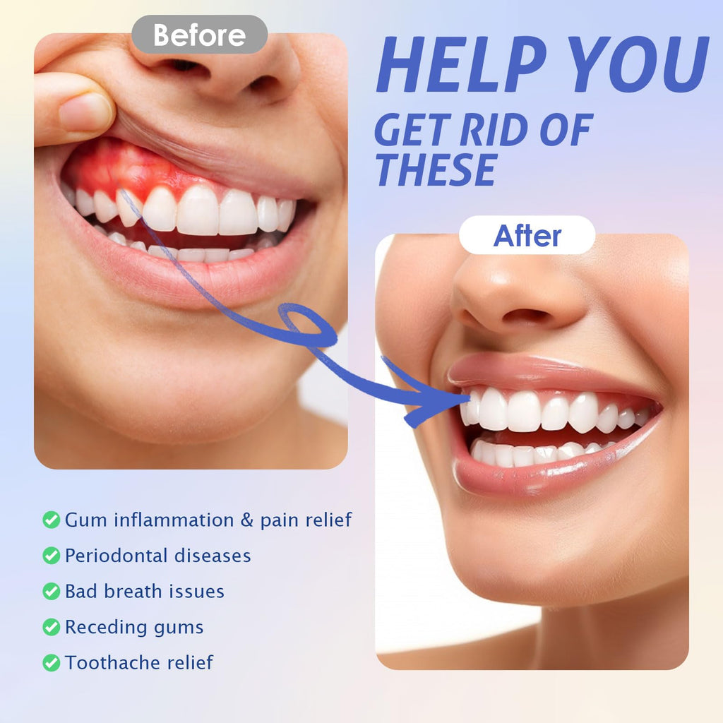 Red Light Therapy Mouthpiece LED Oral Care for Gum Health