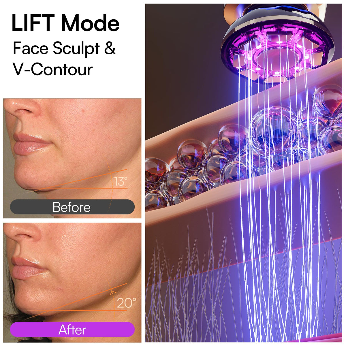 3 in 1 Microcurrent Facial Device Red Light Therapy for Face
