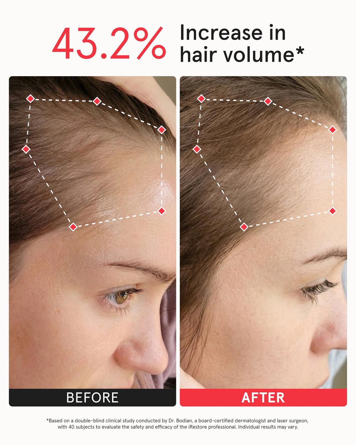 Laser Light Therapy Hair Growth Cap for Hair Regrowth Treatment
