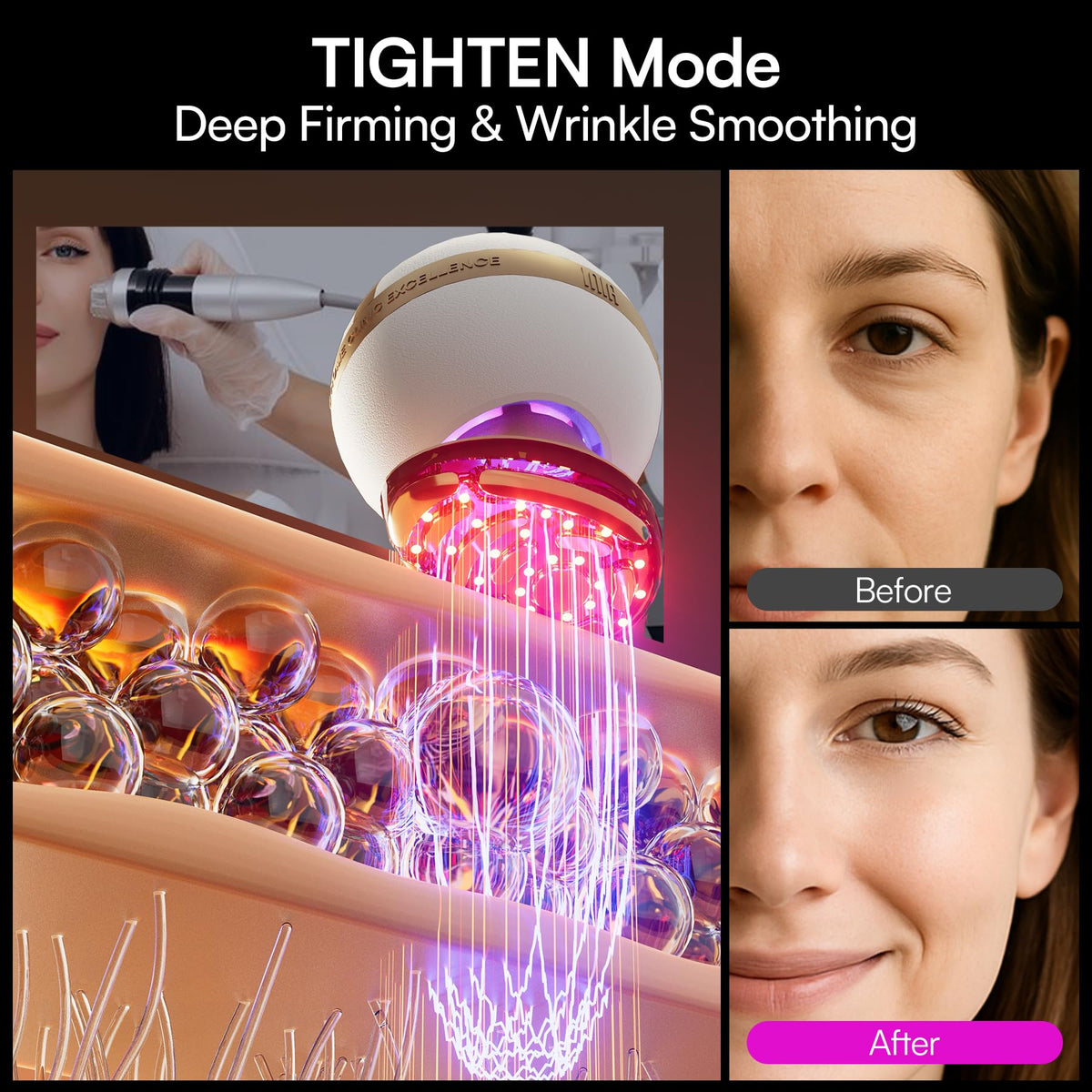 8 in 1 Microcurrent Facial Device for Face and Neck Skin Care