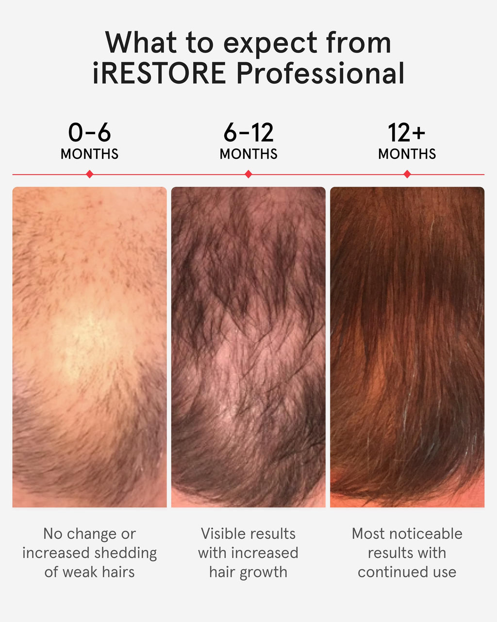 Laser Light Therapy Hair Growth Cap for Hair Regrowth Treatment