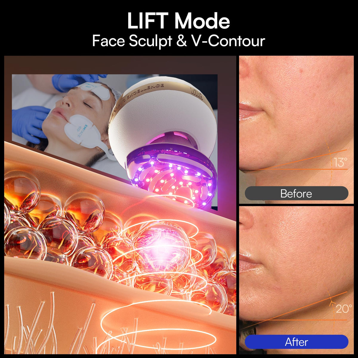 8 in 1 Microcurrent Facial Device for Face and Neck Skin Care